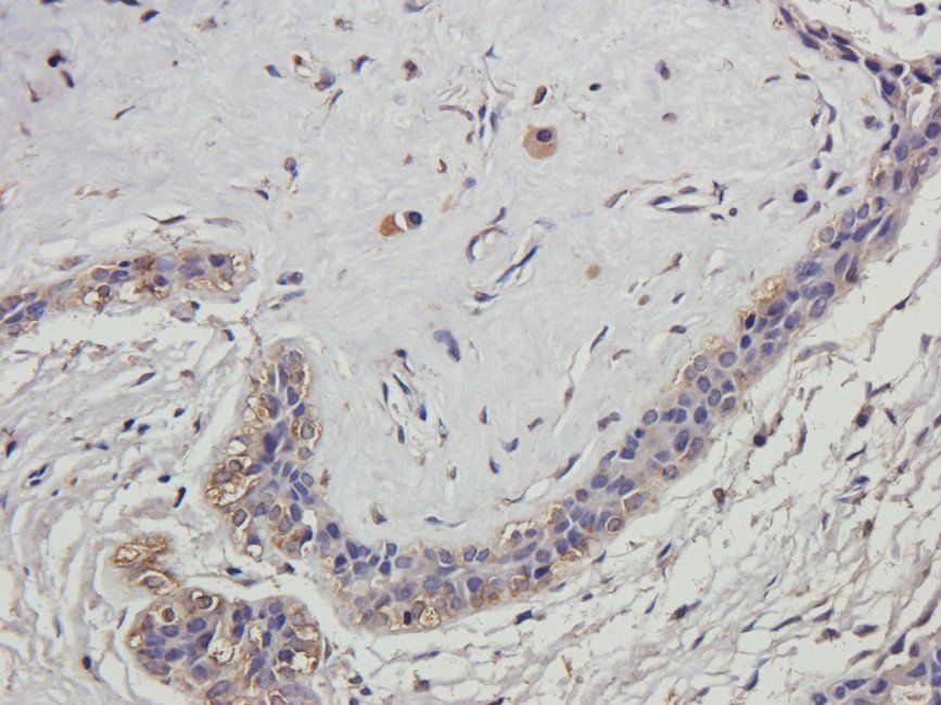 HDAC2 antibody