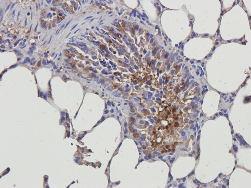 HDAC2 antibody