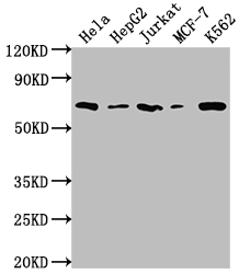 HDAC2 Recombinant Monoclonal Antibody