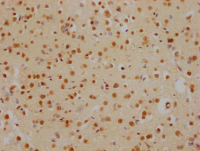 HDAC2 Recombinant Monoclonal Antibody