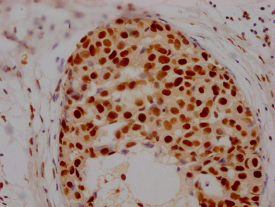 HDAC2 Recombinant Monoclonal Antibody