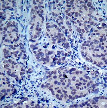 HDAC2 (Ab-394) Antibody