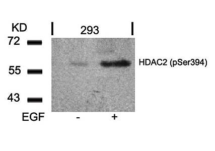 HDAC2 (Phospho-Ser394) Antibody