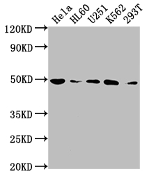 HDAC3 Recombinant Monoclonal Antibody