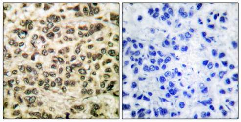 HDAC3 Antibody