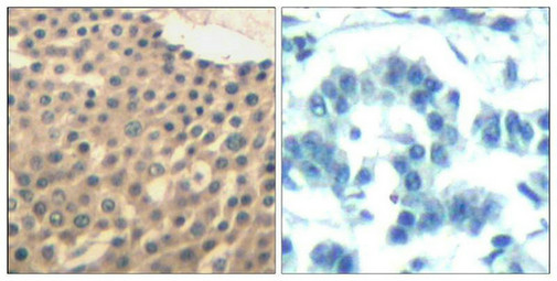 HDAC4/HDAC5/HDAC9 (Ab-246/259/220) Antibody