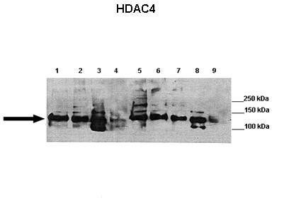 Hdac4 antibody