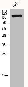 HDAC4 Antibody