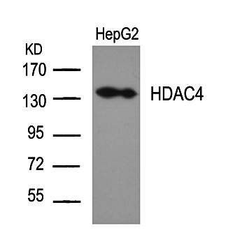 HDAC4 (Ab-632) Antibody