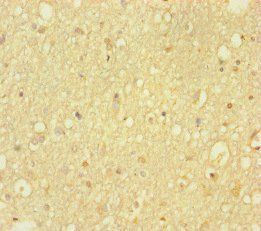 HDAC5 Antibody