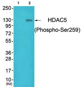 HDAC5 (Phospho-Ser259) Antibody