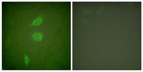 HDAC5 Antibody