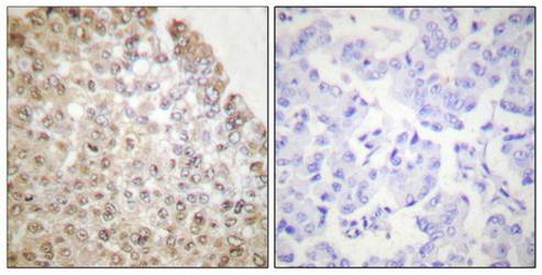 HDAC5 Antibody
