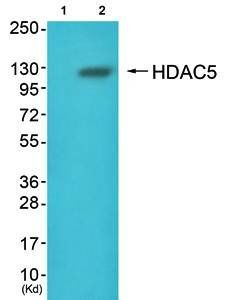 HDAC5 Antibody