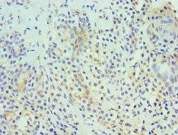 HDAC6 Antibody