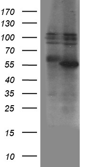 HDAC8 Antibody