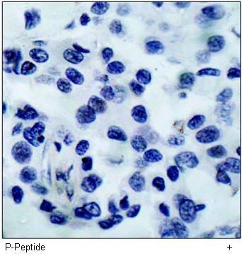 HDAC8 (Phospho-Ser39) Antibody