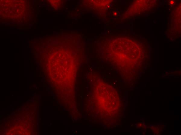 HDAC8 (Phospho-Ser39) Antibody