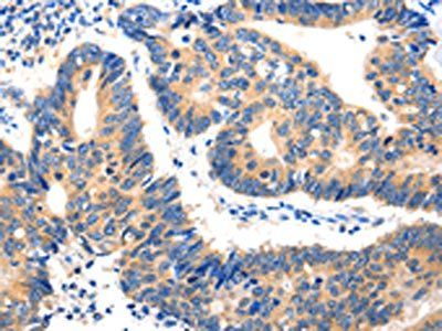 HDC Antibody