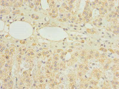 HDHD3 Antibody