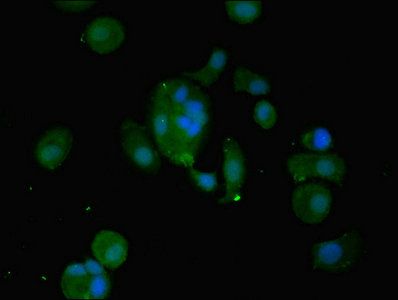 WFDC2 Antibody