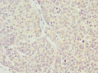 WFDC2 Antibody
