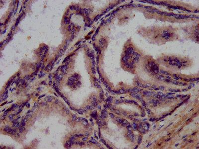 WFDC2 Antibody