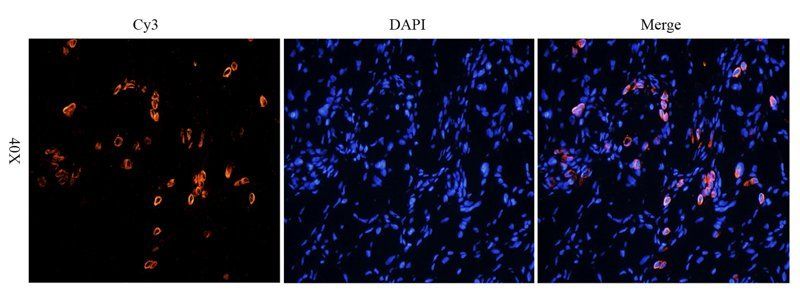 HE4 antibody