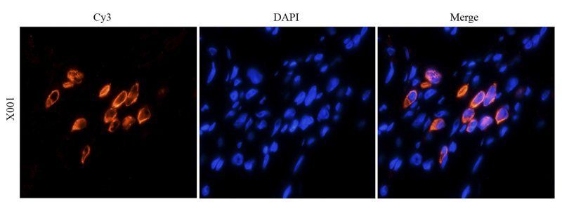 HE4 antibody