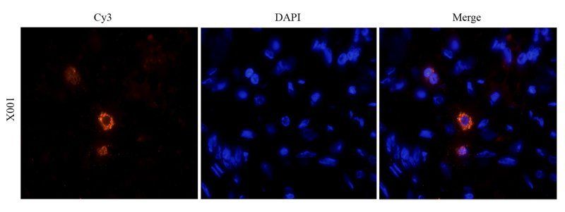 HE4 antibody