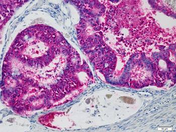 HEA125, Epithelium-specific Glycoprotein, Egp34, EpCAM (CD326)