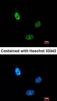 HEAB antibody