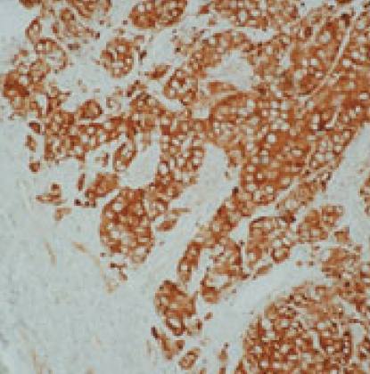 Mouse Human Heat Shock Protein 27 Antibody