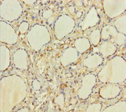 HEBP2 Antibody