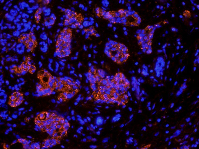 HECTD1 antibody