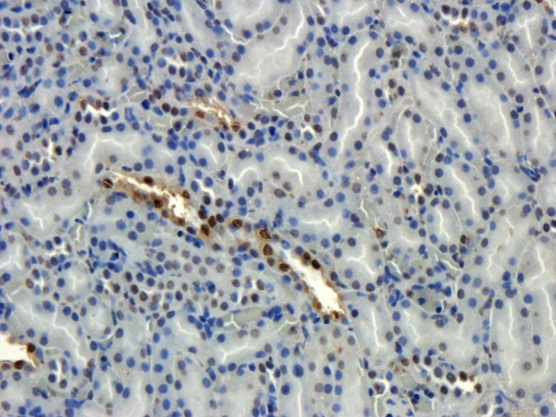 HECTD1 antibody