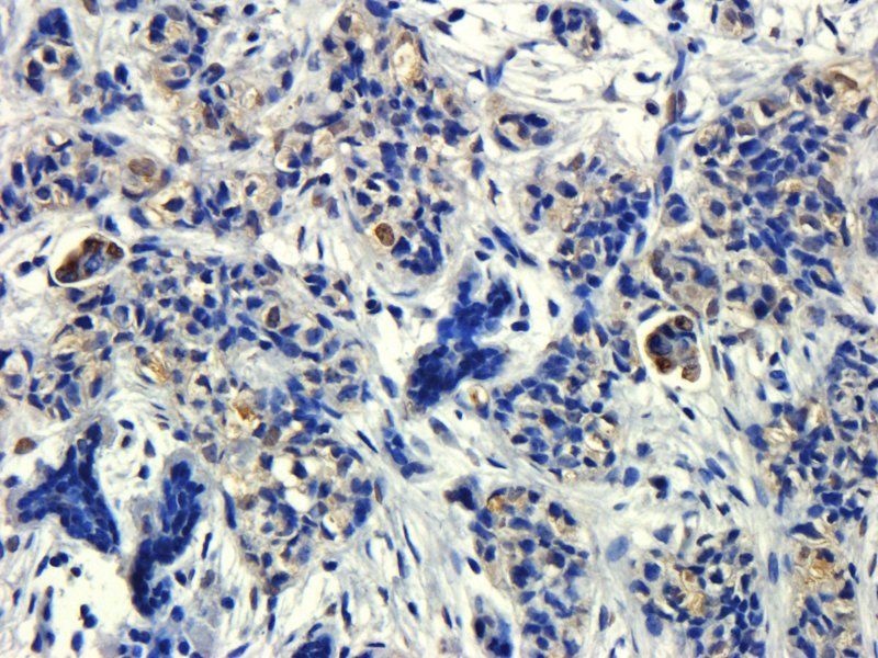 HECTD1 antibody