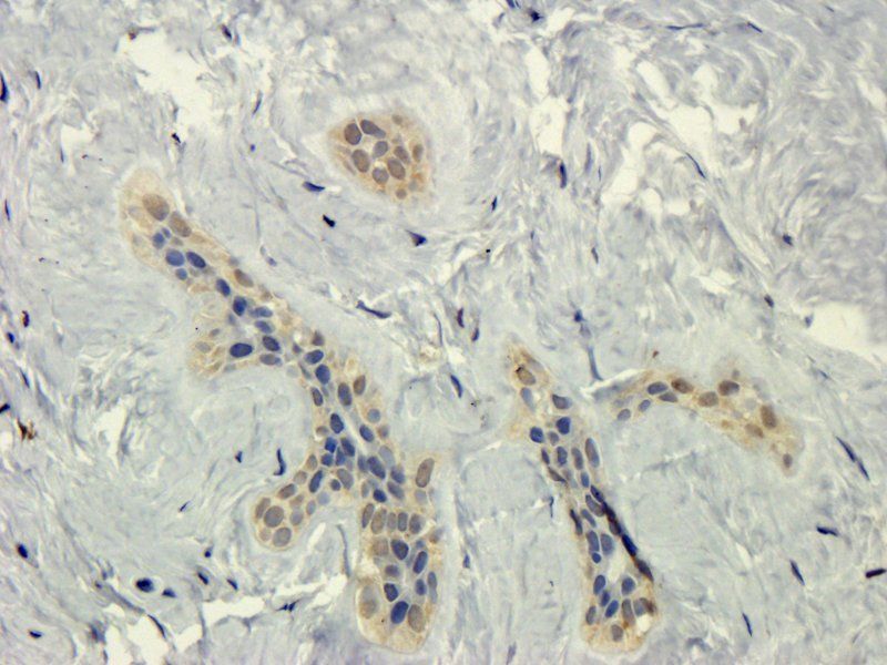 HECTD1 antibody