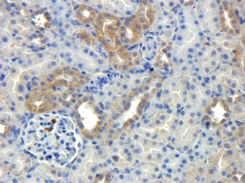 HECTD1 antibody