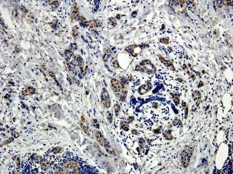 HECTD1 antibody