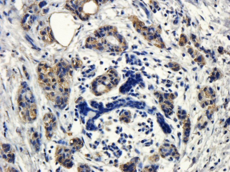 HECTD1 antibody
