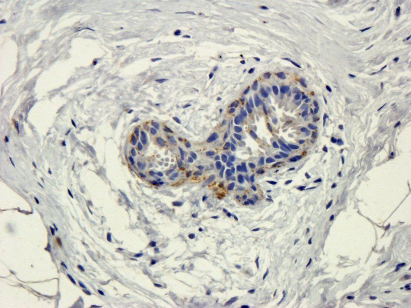 HECTD1 antibody