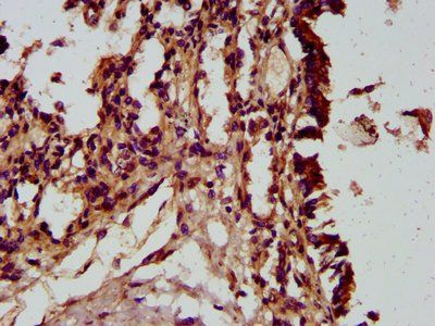 HECTD2 Antibody