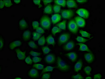 HECW1 Antibody