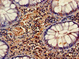 HELLS Antibody