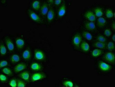 Heme oxygenase 1 protein antibody