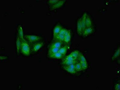 Heme oxygenase 1 protein antibody