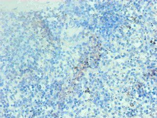 Hemoglobin Antibody
