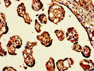 HBB Antibody