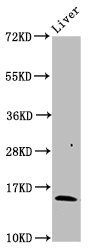 Hemoglobin Beta antibody